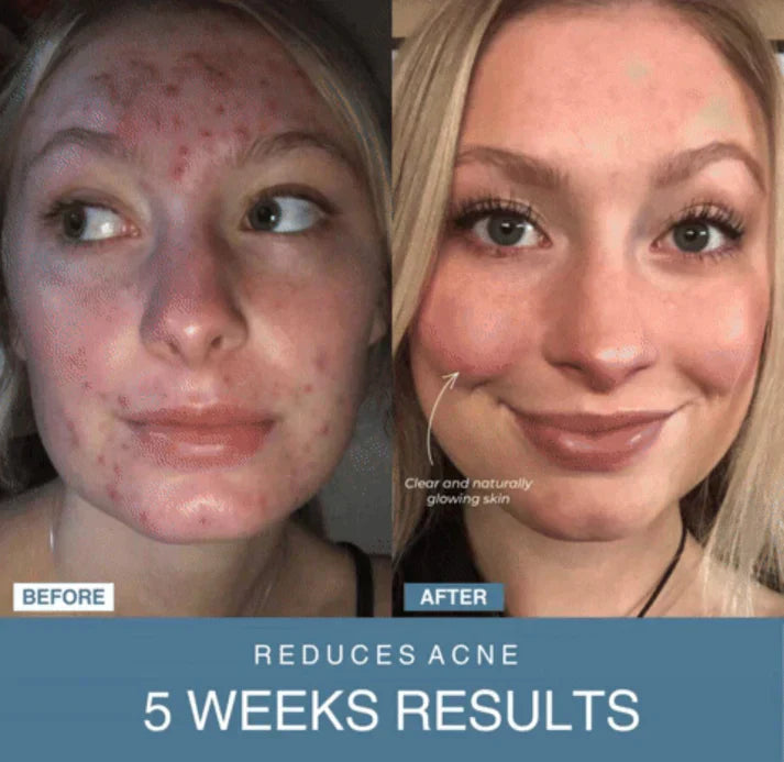 𝐇𝐚𝐩𝐩𝐲 𝐂𝐚𝐫𝐭™ 7-in-1 LED Anti-Aging/Wrinkle Apparatus