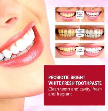 ๐๐๐ฉ๐ฉ๐ฒ ๐๐๐ซ๐ญโขSp-4 Toothpaste