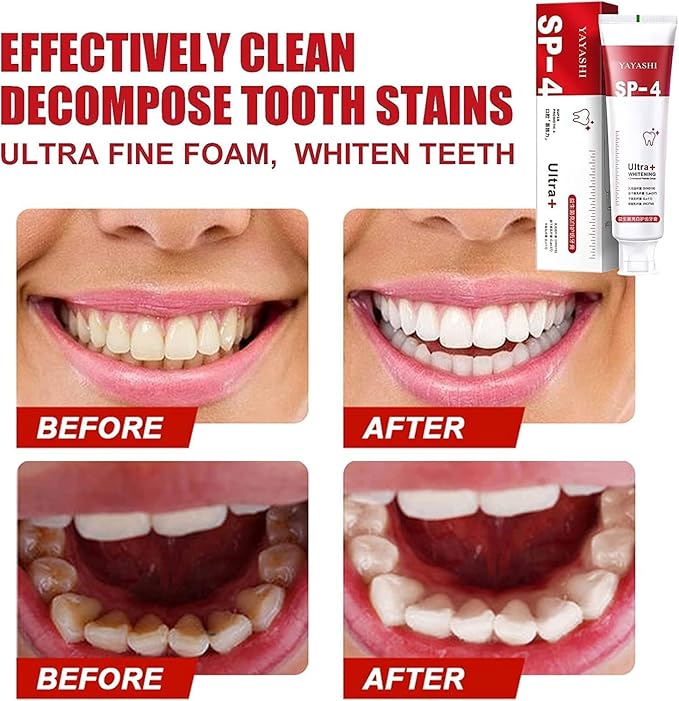 SP 4 Whitening Toothpaste/معجون أسنان مبيض SP 4
