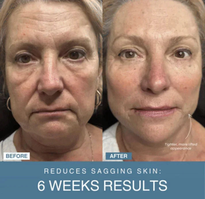 𝐇𝐚𝐩𝐩𝐲 𝐂𝐚𝐫𝐭™ 7-in-1 LED Anti-Aging/Wrinkle Apparatus