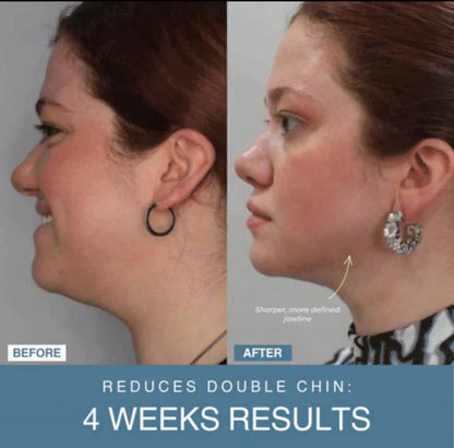 𝐇𝐚𝐩𝐩𝐲 𝐂𝐚𝐫𝐭™ 7-in-1 LED Anti-Aging/Wrinkle Apparatus